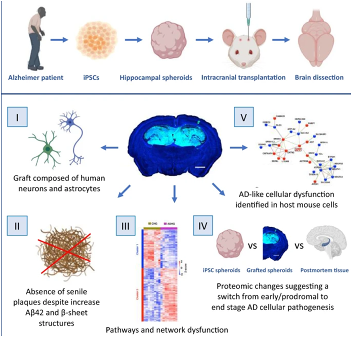 Acta Neuropathol Com：利用源自阿爾茨海默病患者的誘導(dǎo)性多能干細(xì)胞構(gòu)建新的疾病模型，有助更好理解這種疾病如何在大腦中進(jìn)展